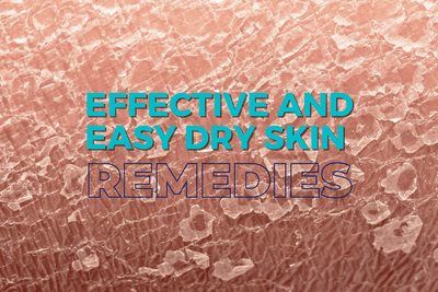 Effective and Easy Dry Skin Remedies
